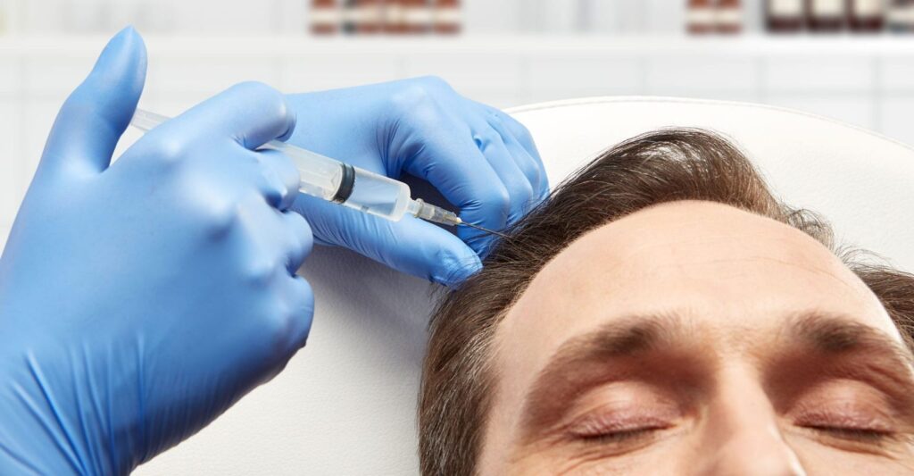 Best PRP Hair Treatment for Hair Growth in Dubai Explained