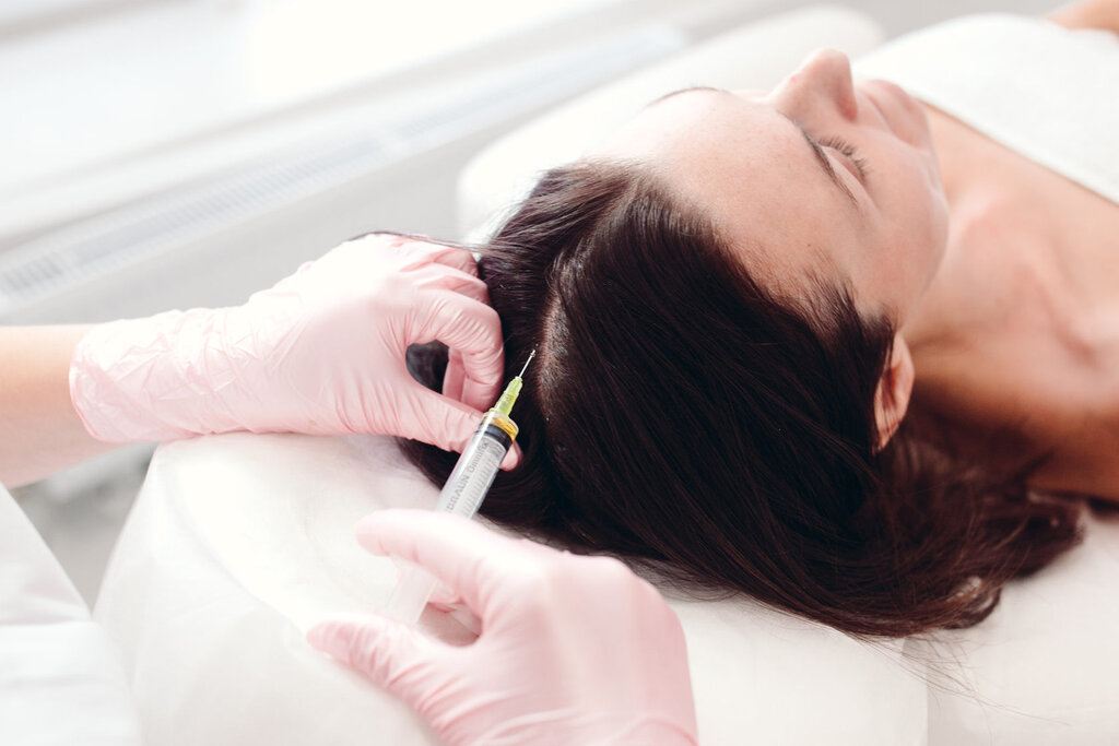 Best PRP Hair Treatment in Dubai