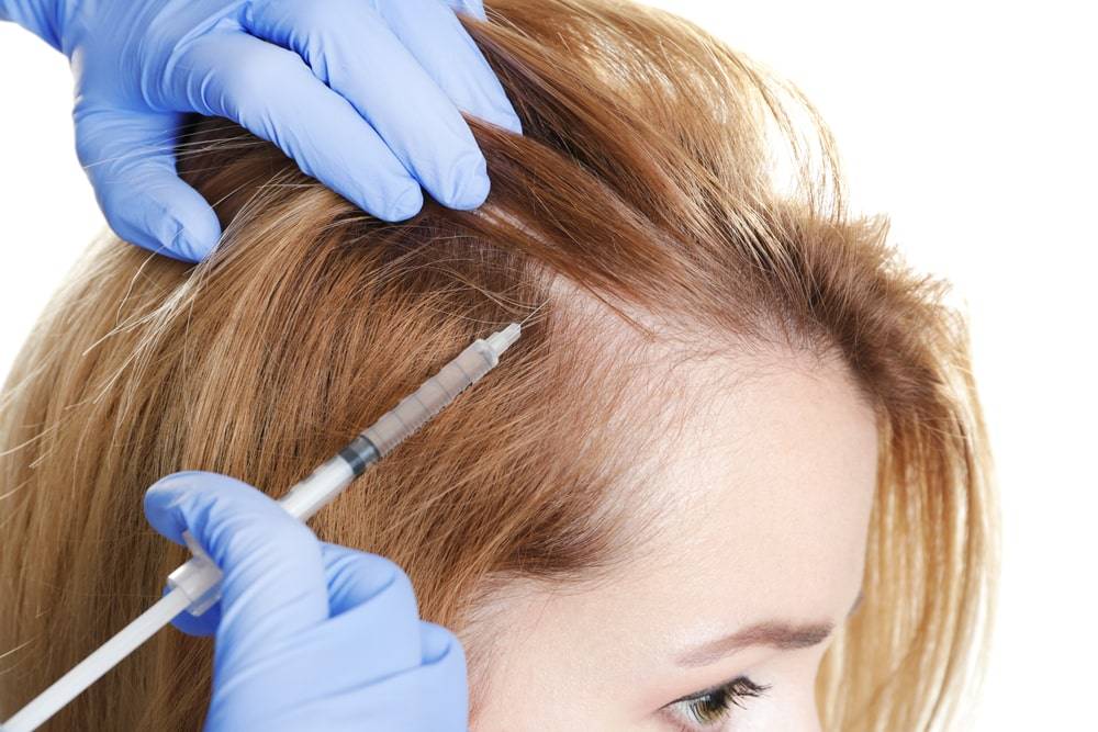 Are Prp Hair Treatments In Dubai Safe?