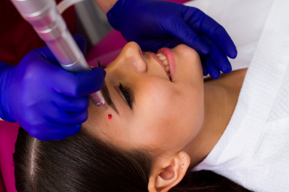 Dynamic Aesthetic – Dubai’s Solution for Birthmark Concerns