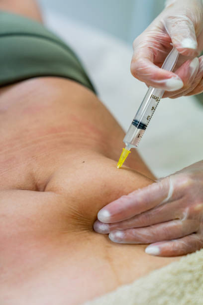 How to Prepare for Fat Dissolving Injections in Dubai