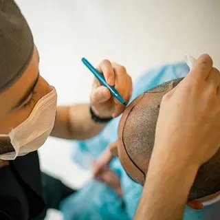 How Hair Transplant Technology Is Changing the Beauty Industry in Islamabad