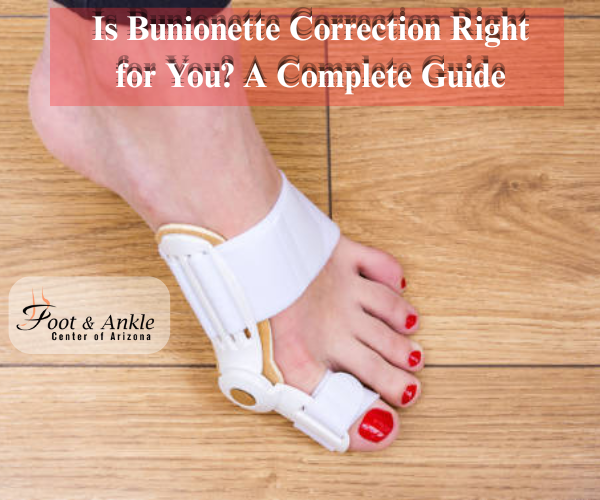 Is Bunionette Correction Right for You? A Complete Guide