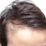 Front Line Hair Fixing Benefits