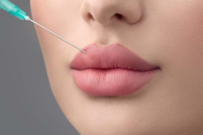 Best Aesthetic Clinics in Dubai: Where Professional Care Meets Russian Lip Fillers
