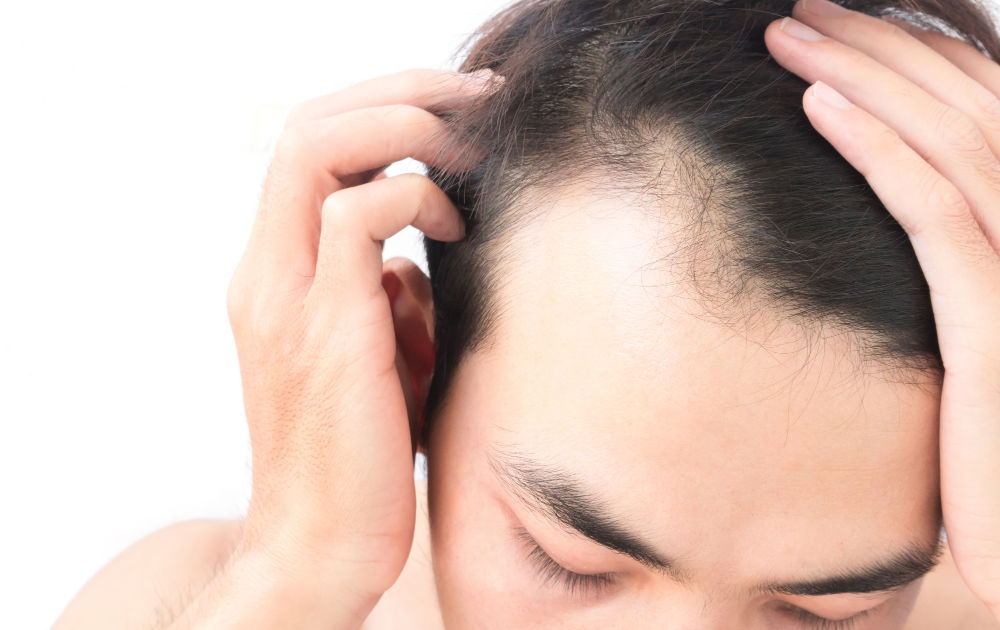 Who Can Benefit from Front Line Hair Fixing?