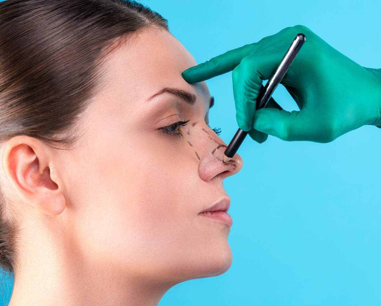 Rhinoplasty in Dubai