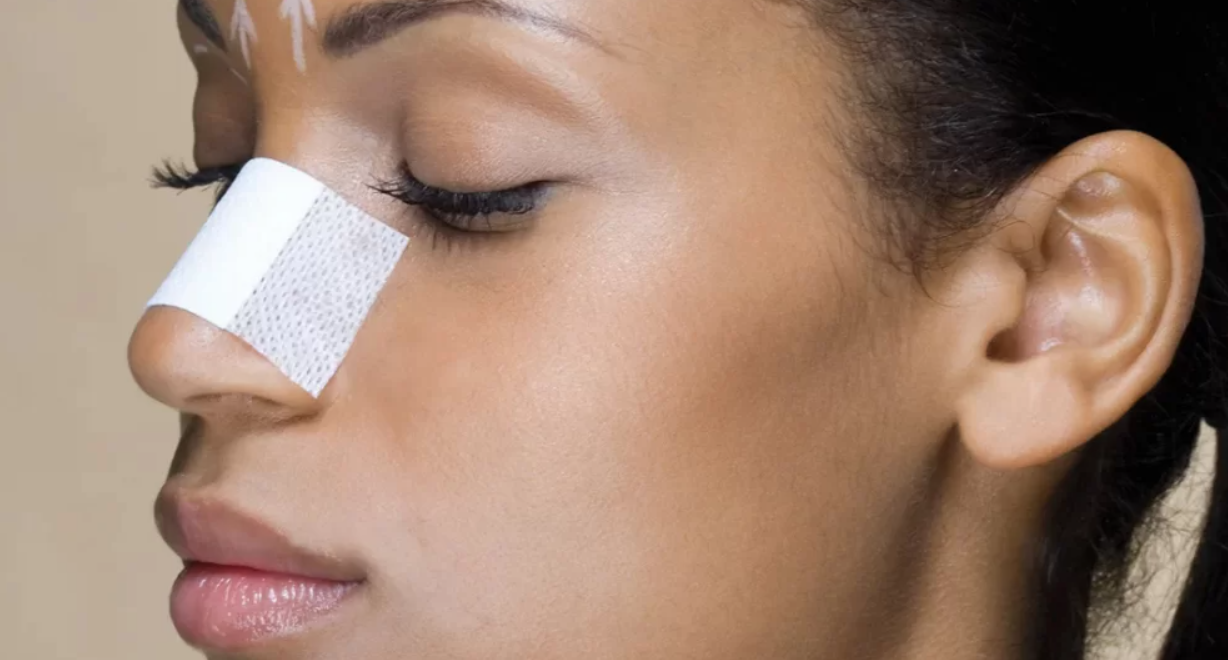 Rhinoplasty in Dubai