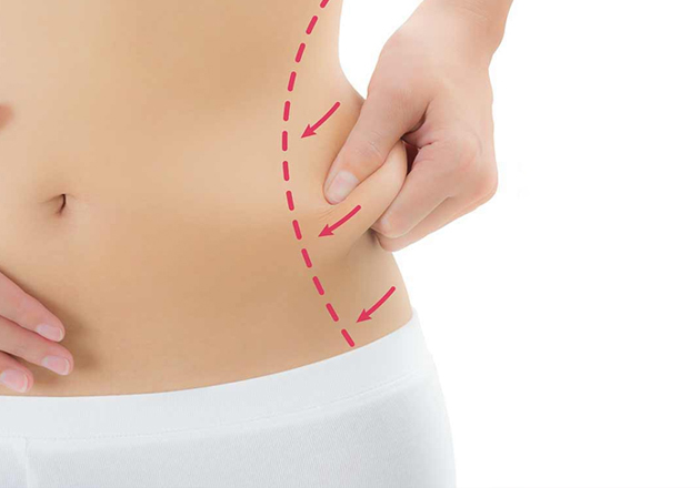 See Real Results with GPS Laser Lipo