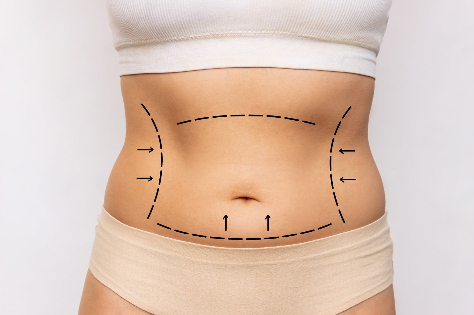 How Tummy Tuck in Dubai Transforms Bodies