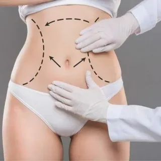 Tummy Tuck Surgery Success Rate in Islamabad