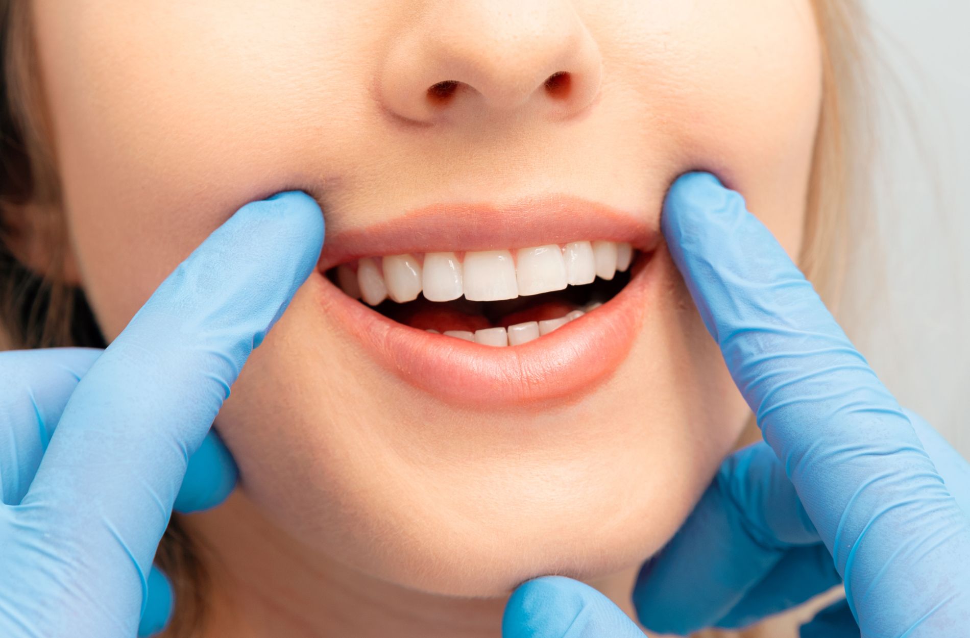 What Happens If a Dental Implant Fails in Dubai—Is Repair or Replacement Possible
