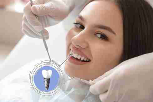 What You Need to Know About Smoking and Dental Implant Success