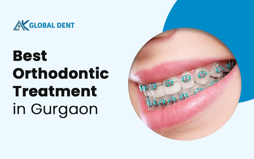 Orthodontic Treatment for Kids- 5 Things to Know