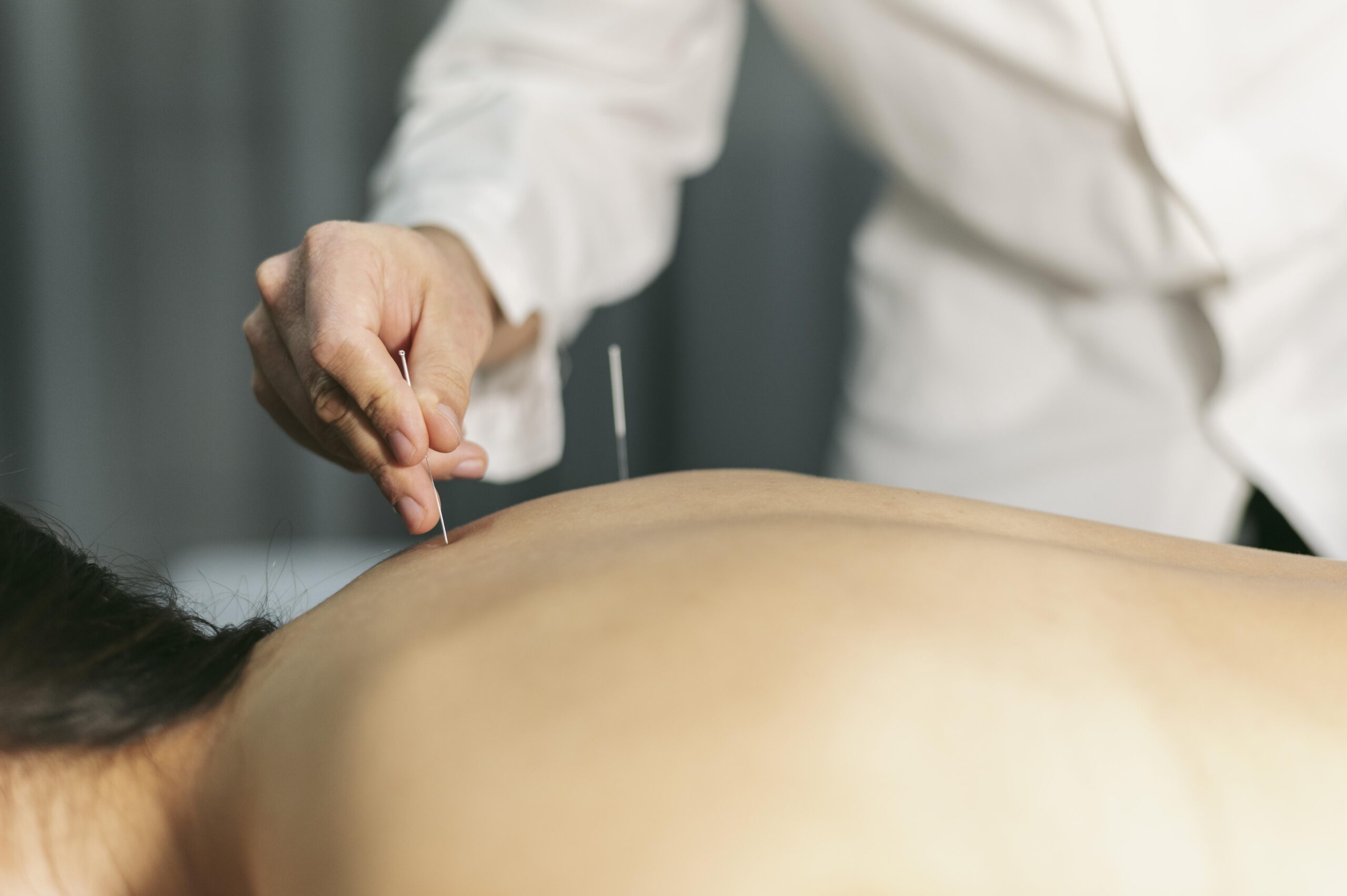 Discover Youthful Skin Through Cosmetic Acupuncture in Louisville KY