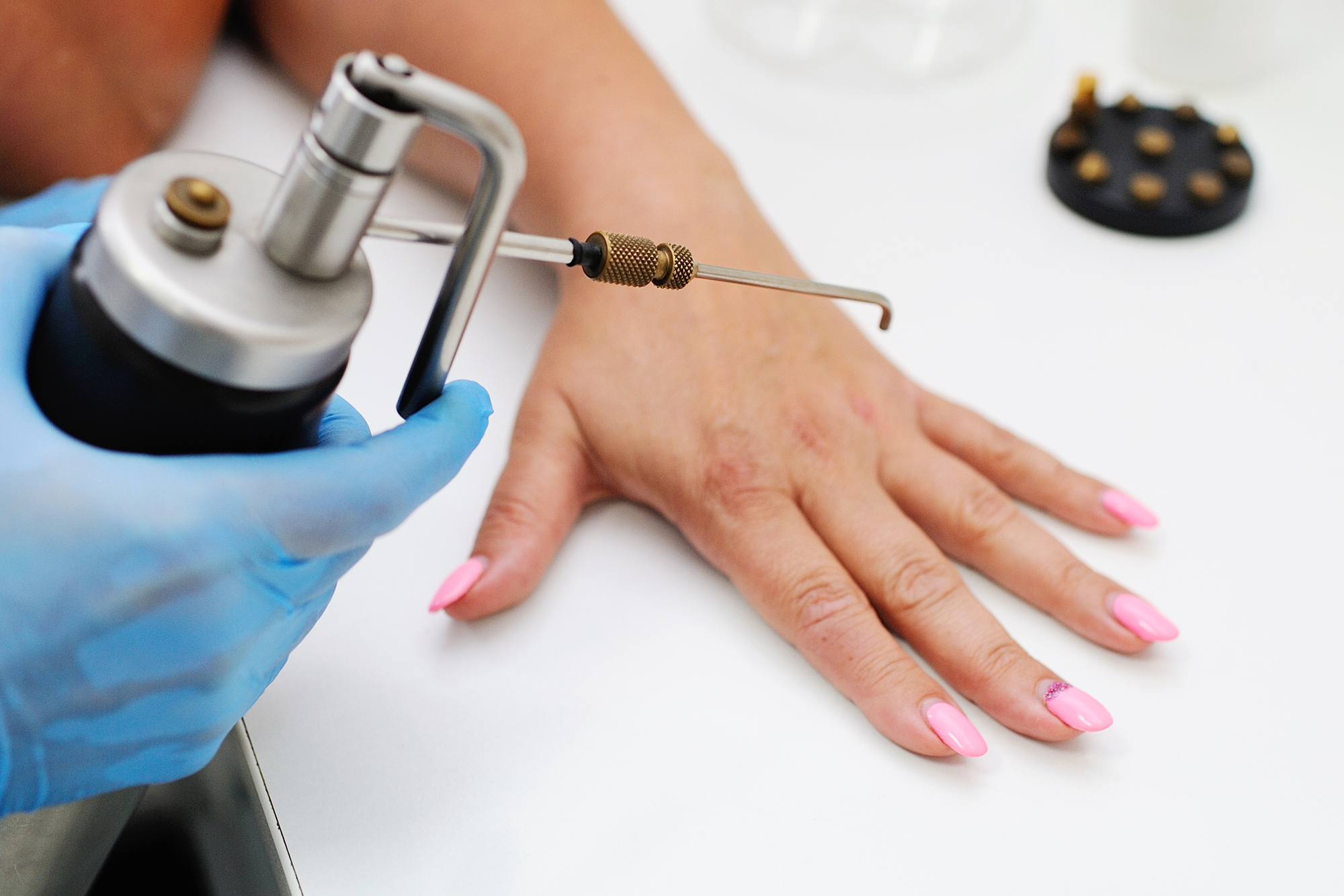 How Cryotherapy for Warts Can Help You Regain Smooth, Clear Skin