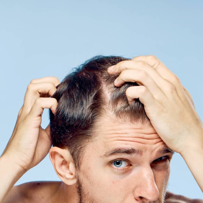 Front Line Hair Fixing Guide