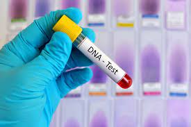 DNA Test for Health: How Long Before You Get Results?