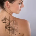 Tattoo Removal Before Marriage: A Common Trend in Islamabad?