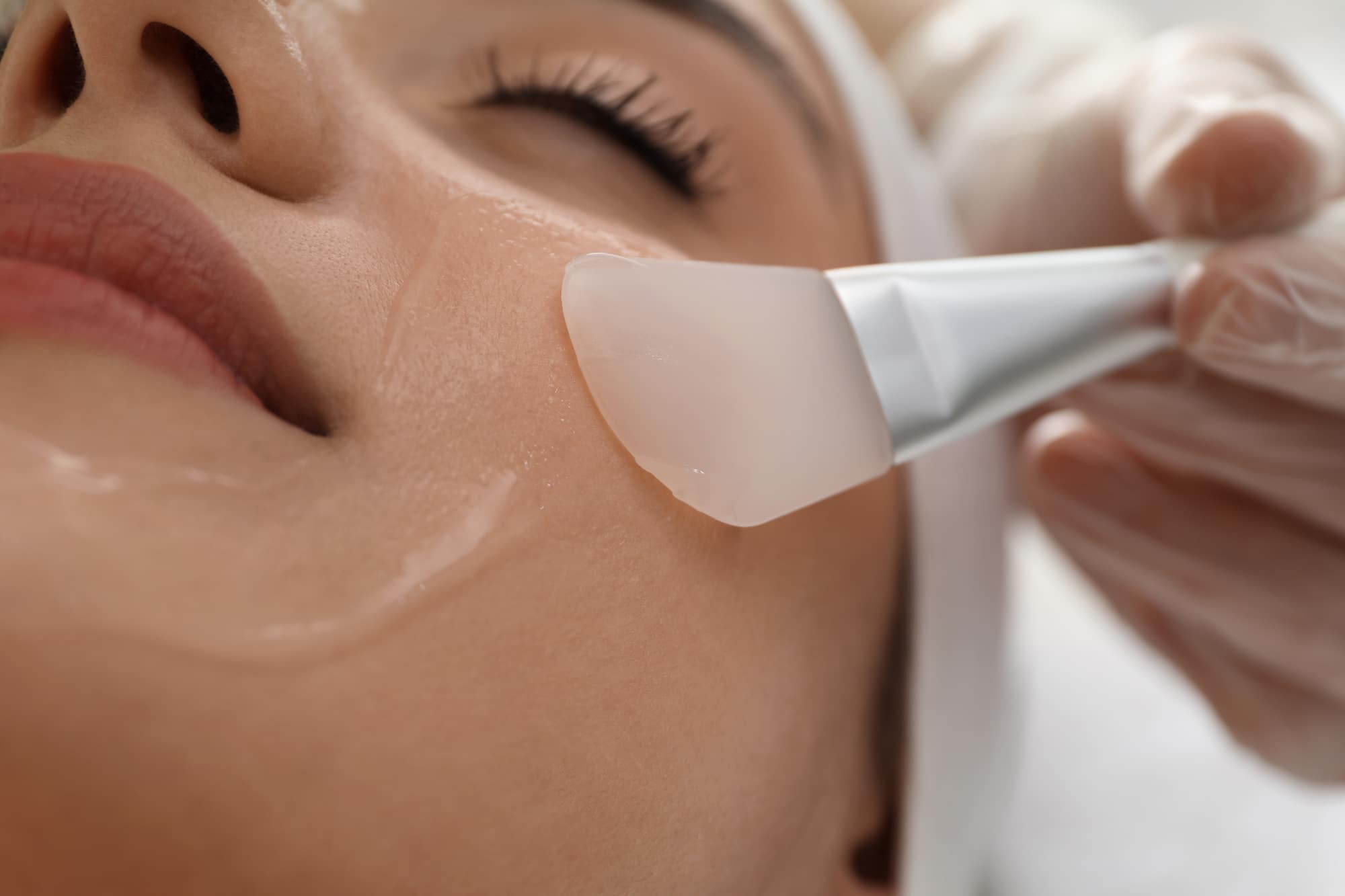 Is cold peel suitable for sensitive skin?