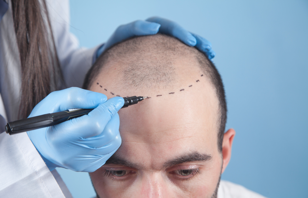 Front Line Hair Fixing in Dubai