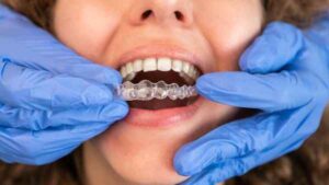 Invisalign Glasgow