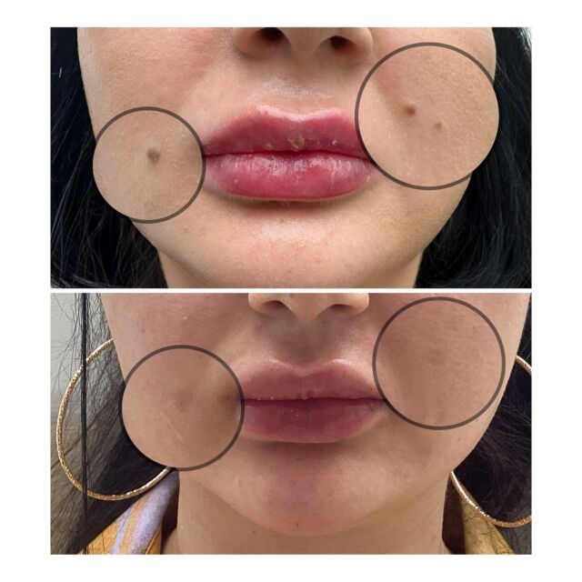 Radiant Skin Finding the Best Skin Clinic in Richmond