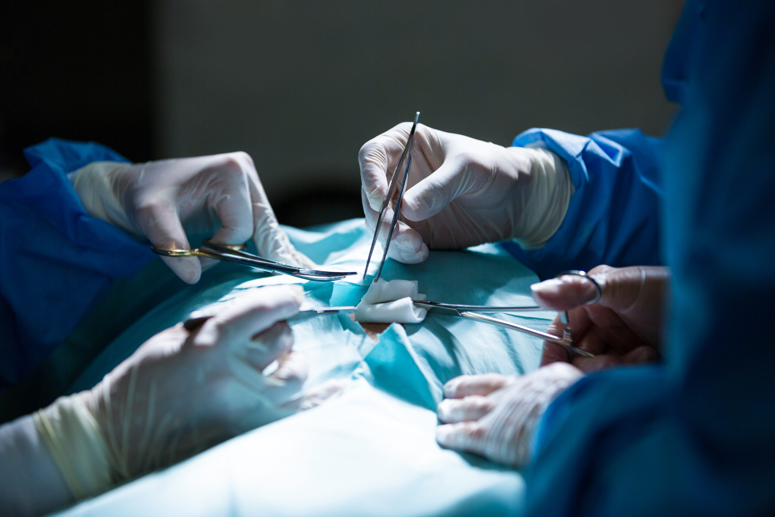 What Happens During Laparoscopic Surgery? A Simple Guide for First-Time Patients
